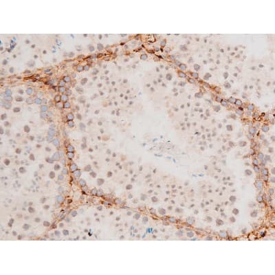 Polyclonal Rabbit anti-Human GATA4 Antibody (phospho-Ser262, IHC, IF, WB)