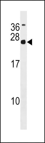 Polyclonal Rabbit anti-Human MRGBP Antibody (aa46-75, WB)