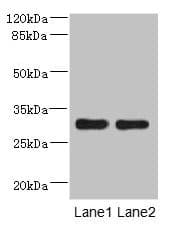Polyclonal Rabbit anti-Human DRAM2 Antibody (IHC, IF, WB)