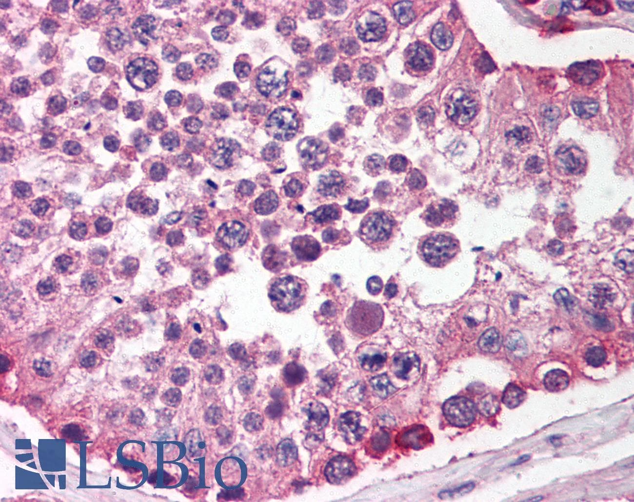 IHC-plus™ SIRPA / CD172a Antibody