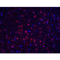 BTK Antibody