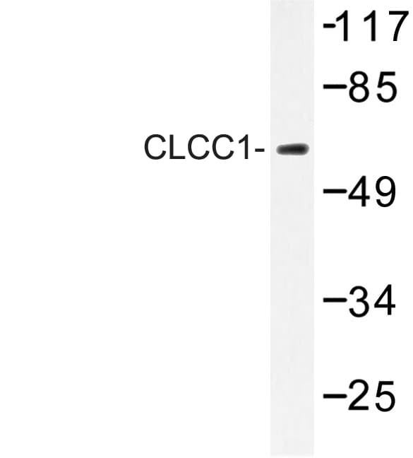 CLCC1 Antibody (Asp429)