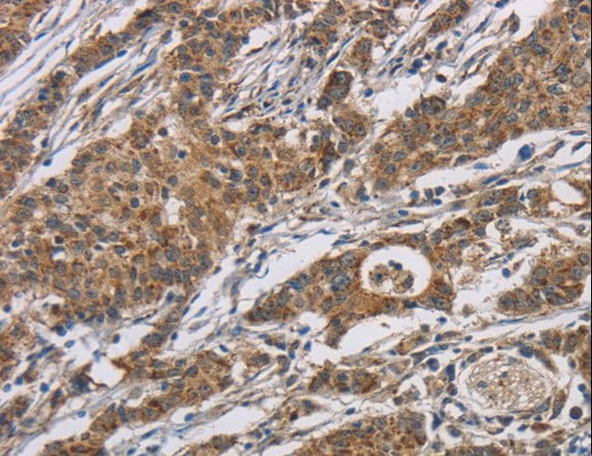 Polyclonal Rabbit anti-Human AGER / RAGE Antibody (IHC, WB)