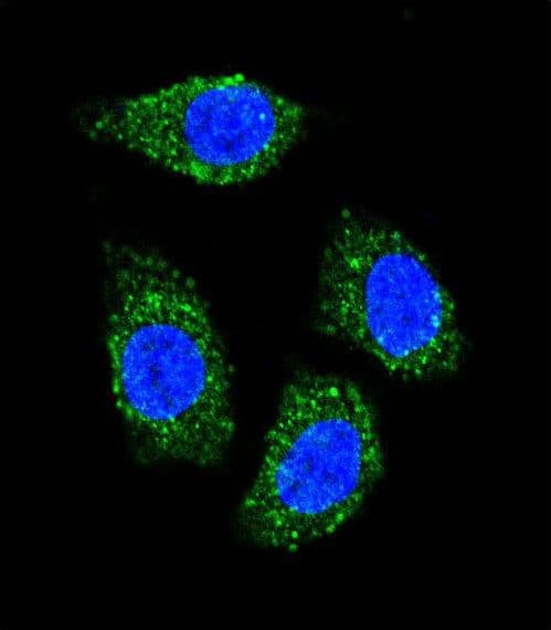 Polyclonal Rabbit anti-Human TNFSF15 / TL1A / VEGI Antibody (aa148-175, IF, WB)
