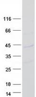 Human CMSS1 Protein (Recombinant Myc-DDK (Flag))