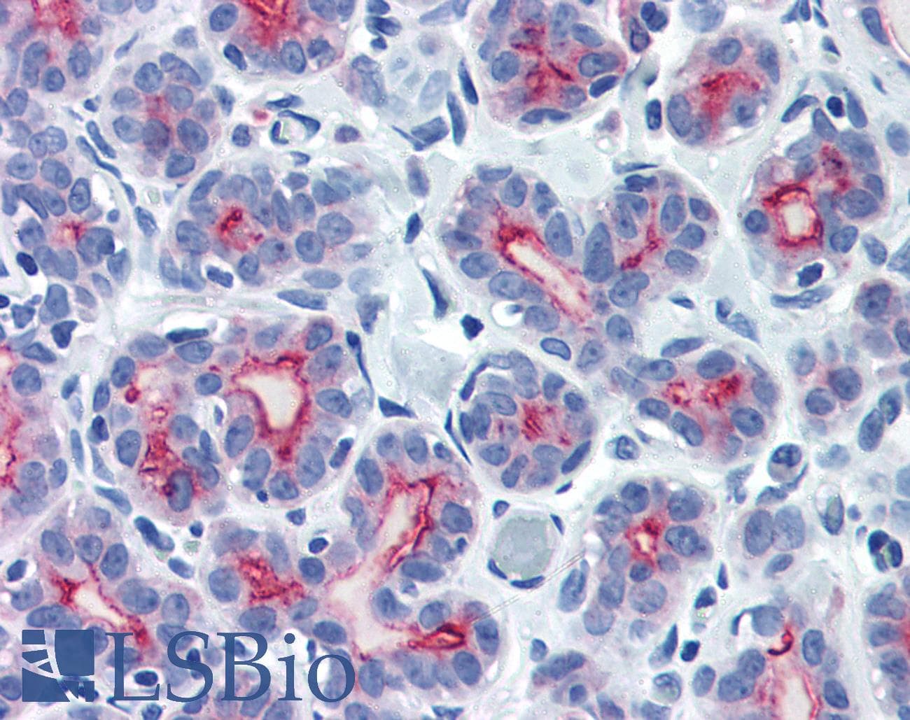 IHC-plus™ Polyclonal Rabbit anti-Human EMA / MUC1 Antibody (C-Terminus, IHC)