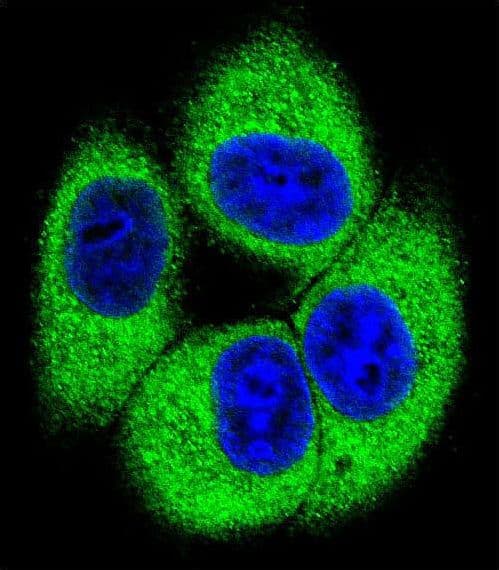 TSSK4 / TSSK5 Antibody (aa226-254)