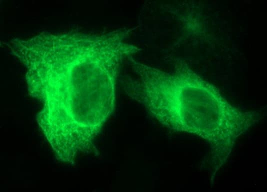 TUBB2A / Tubulin Beta 2A Antibody (clone OTI3B7)