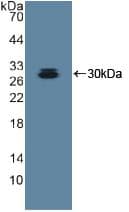 ADAM10 Antibody (aa420-641, APC)