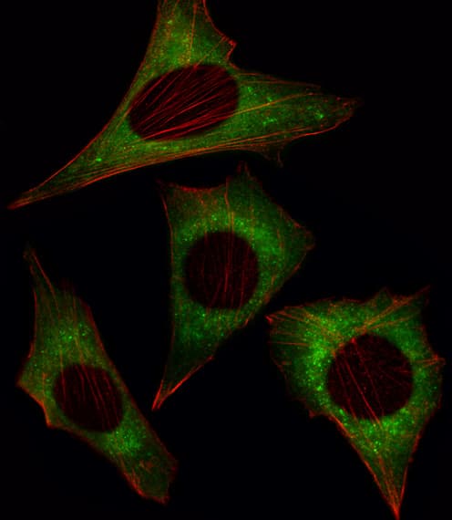 MOB1B / MOBKL1A Antibody (aa177-206)