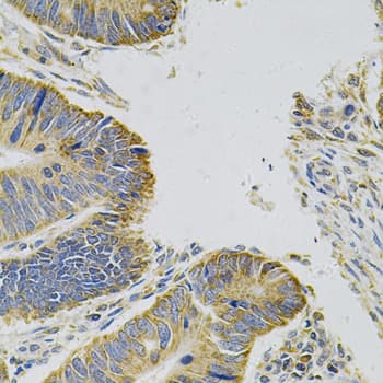 MYD88 Antibody