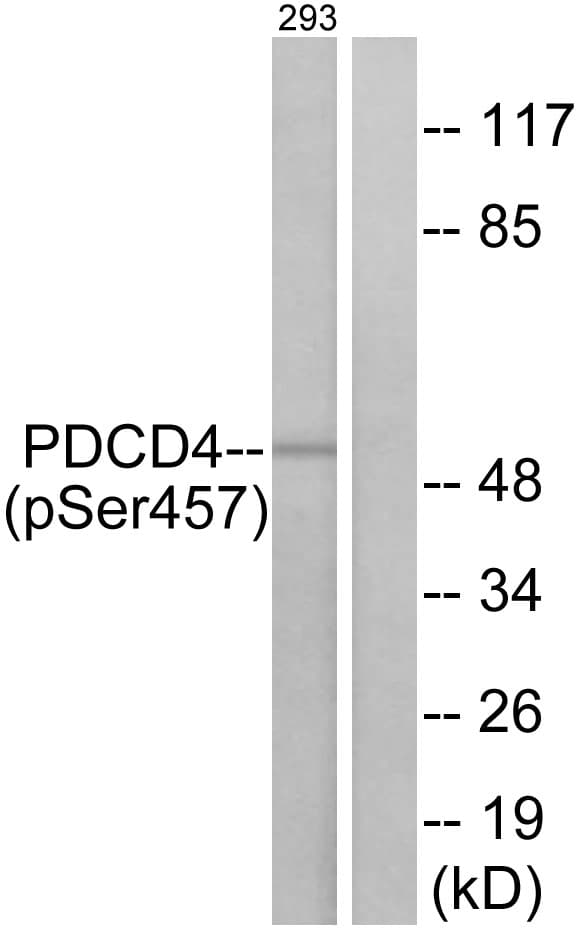 Polyclonal Rabbit anti-Human PDCD4 Antibody (phospho-Ser457, IHC, WB)