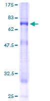 Human PIGO Protein (Recombinant GST)