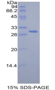 Rat FDFT1 / Squalene Synthase Protein (Recombinant His)