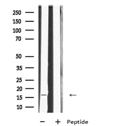 Polyclonal Rabbit anti-Human MRPL23 Antibody (WB)