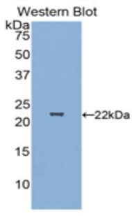 Polyclonal Rabbit anti-Human PARK7 / DJ-1 Antibody (Biotin, aa1-189, WB)