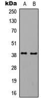 Polyclonal Rabbit anti-Human GNAL Antibody (Internal, WB)
