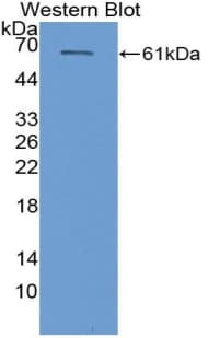 CYP26B1 Antibody (aa1-512)