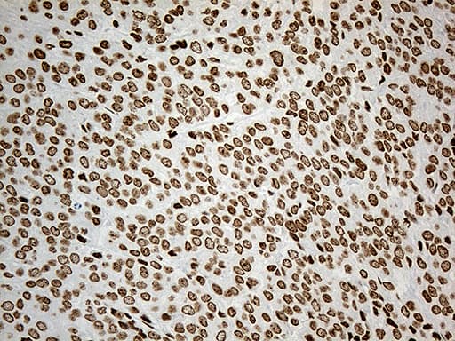 Monoclonal Mouse anti-Human IRF2BP1 Antibody (clone OTI3A6, Carrier-free, aa457-584, IHC, WB)