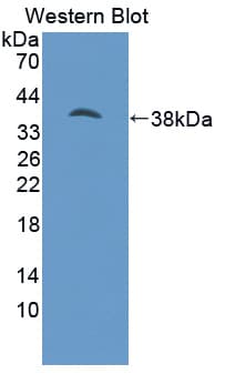 PathPlus™ SYN1 / Synapsin 1 Antibody (aa113-420)