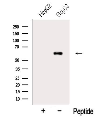 Polyclonal Rabbit anti-Human MTF2 / PCL2 Antibody (WB)