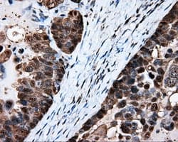 Heat Shock Protein 70 / HSPA1A Antibody (clone OTI3G9)
