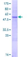 Human FBP / FOLR2 Protein (Recombinant GST)