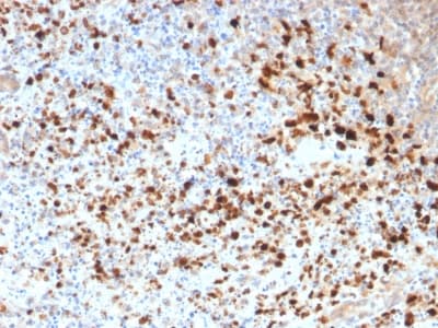HSV-1 / Herpes Simplex Virus 1 Antibody (clone HSV1/1934)