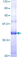 Human CDK5R1 Protein (Recombinant GST, N-terminus)