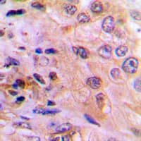 DUSP6 / MKP3 Antibody (Internal)