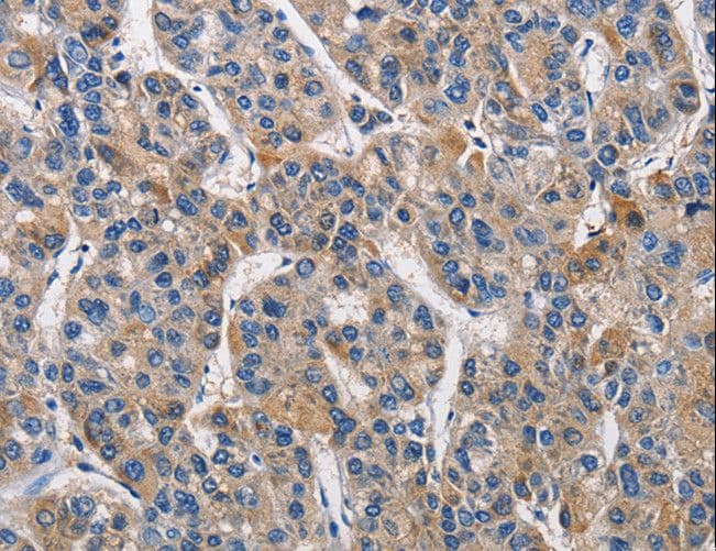KLK1 / Kallikrein 1 Antibody