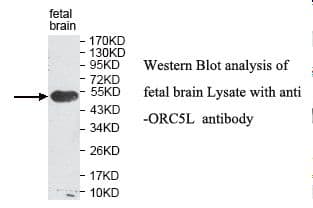 ORC5 Antibody (aa65-354)