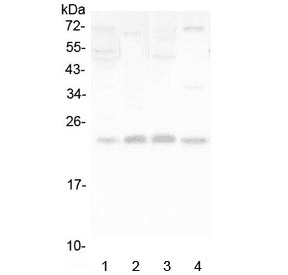 Polyclonal Rabbit anti-Human LMO2 Antibody (WB)