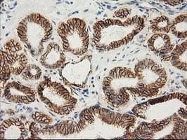 CTNNB1 / Beta Catenin Antibody (clone OTI1B11)