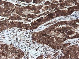 STK38L / NDR2 Antibody (clone OTI4D8)
