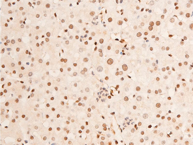 JUN / c-Jun Antibody (phospho-Thr93)