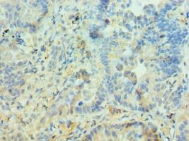 Polyclonal Rabbit anti-Human PIAS3 Antibody (aa399-628, IHC)