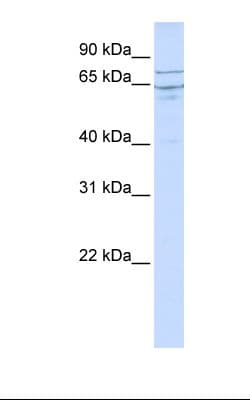 Polyclonal Rabbit anti-Human EDEM1 / EDEM Antibody (aa146-195, WB)