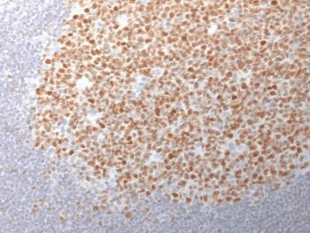 BCL6 Antibody (clone BCL6/1982)