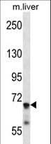 Polyclonal Rabbit anti-Human IL1R1 Antibody (aa422-450, WB)