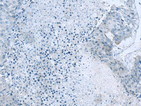 GLS / Glutaminase Antibody