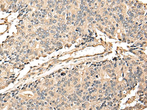 EEF1E1 / AIMP3 Antibody