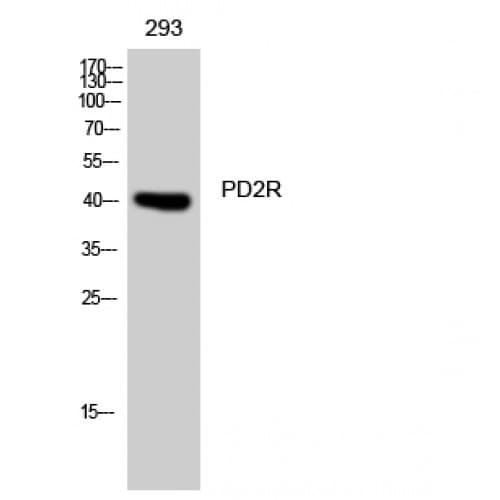 Polyclonal Rabbit anti-Human Prostaglandin D2 Receptor Antibody (230-310 aa, C-terminal, IHC, IF, WB)