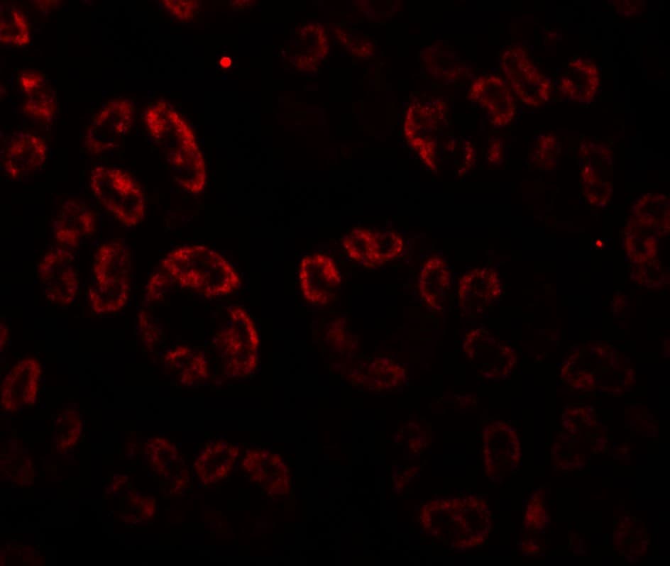 IHC-plus™ SKIV2L / SKI2 Antibody