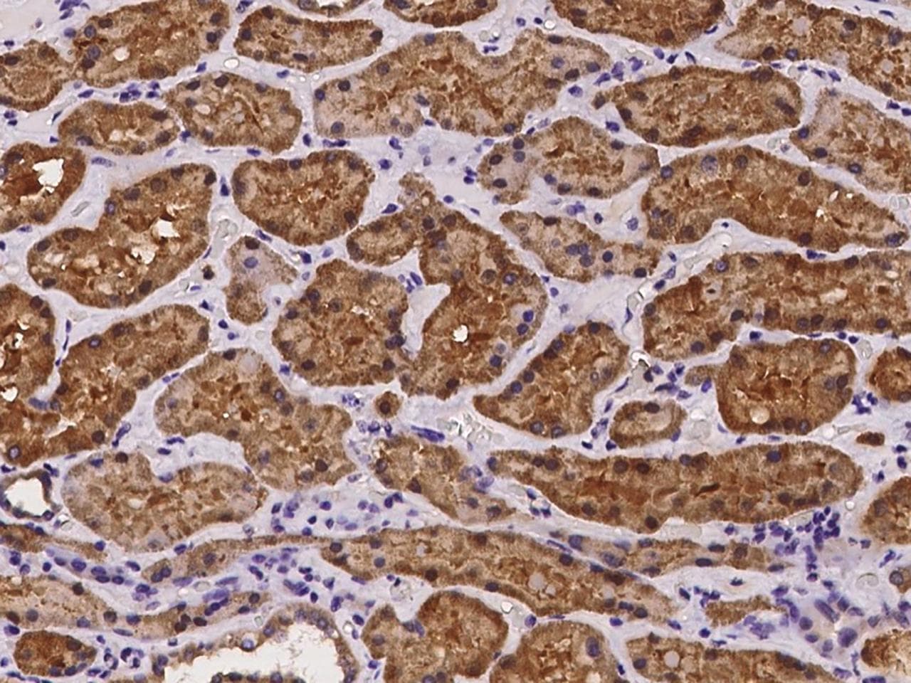 AMDHD1 Antibody