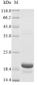 Rat Reg3b Protein (Recombinant 6His-SUMOstar, N-terminus)
