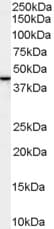 IHC-plus™ SPFH2 / ERLIN2 Antibody (aa328-339)