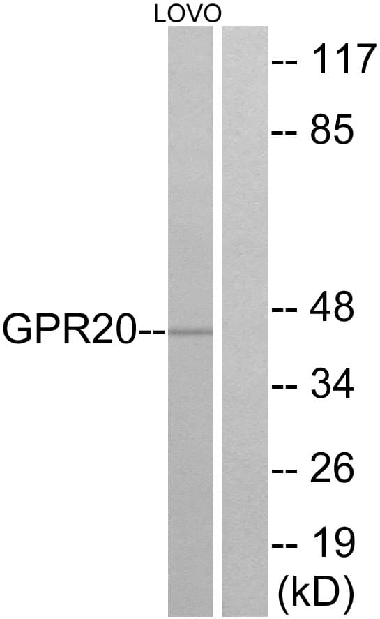 IHC-plus™ GPR20 Antibody (aa291-340)
