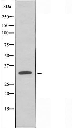 SDC1 / Syndecan 1 / CD138 Antibody