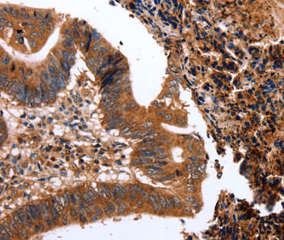 Polyclonal Rabbit anti-Human CLECSF6 / DCIR Antibody (IHC, WB)